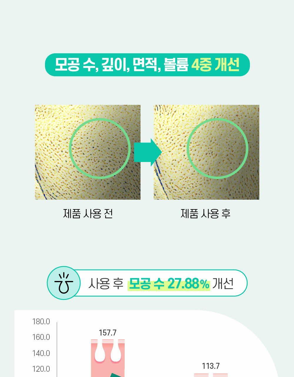 모공 수, 깊이, 면적, 볼륨 4중 개선