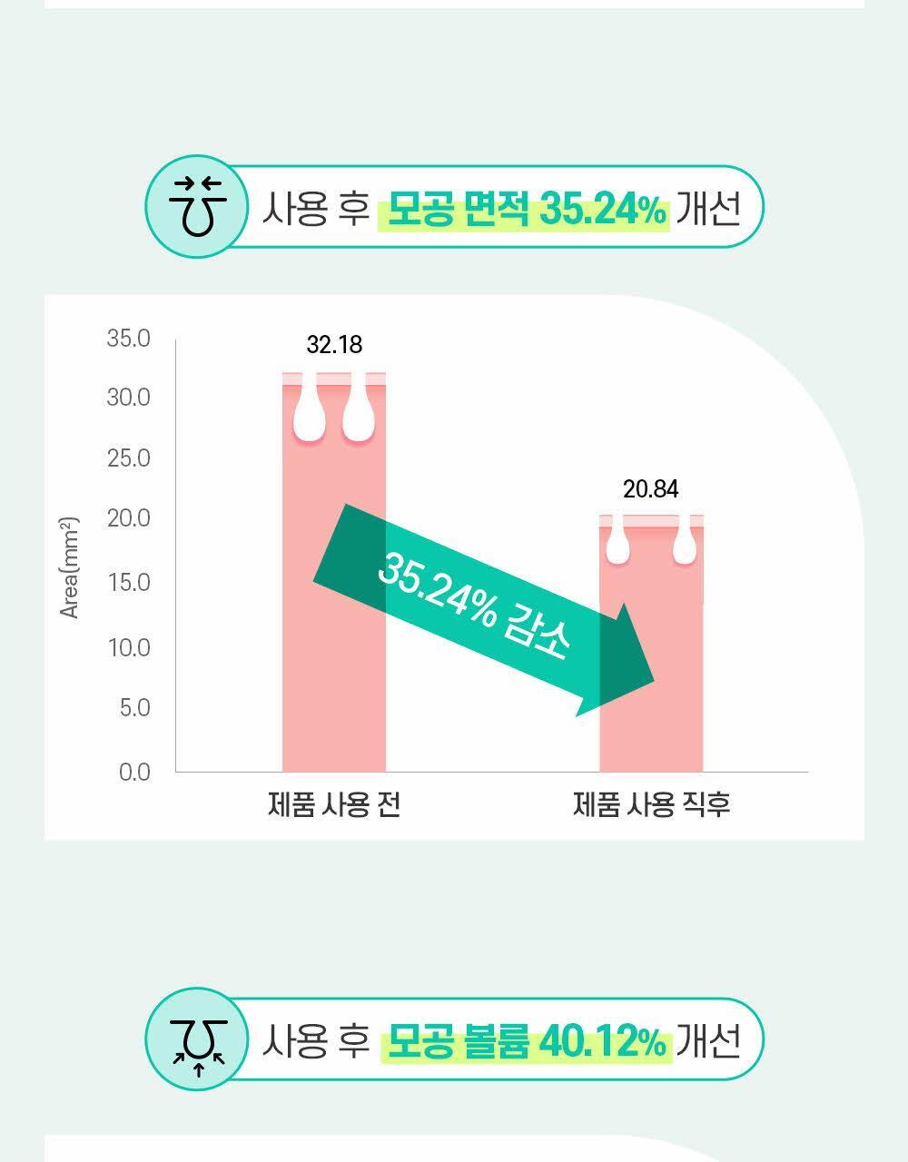 모공 수, 깊이, 면적, 볼륨 4중 개선