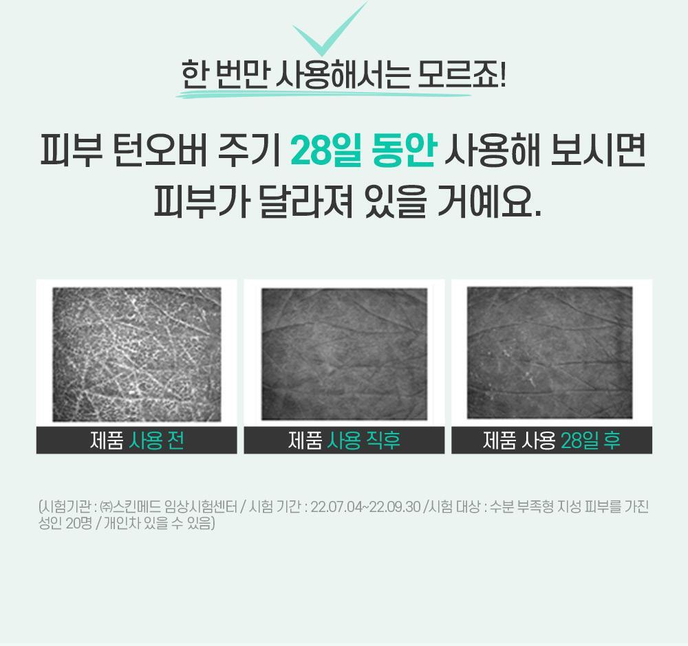 모공/각질에 정조준 리얼베리어만의 성분 황금비율로 시원하게 각질, 피지 제거해줘요.