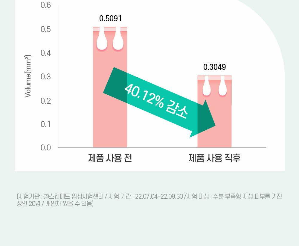 모공 수, 깊이, 면적, 볼륨 4중 개선