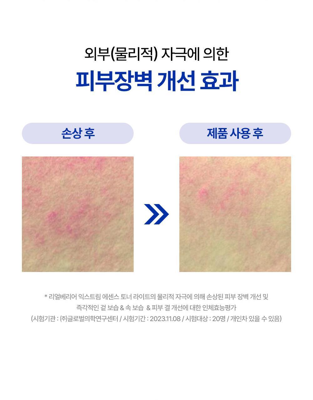 외부(물리적) 자극에 의한 피부장벽 개선 효과