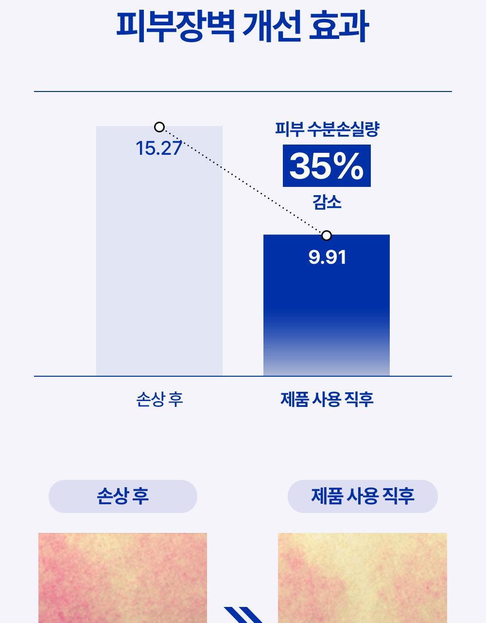 POINT 03. Strengthen the skin barrier damaged by UV rays!