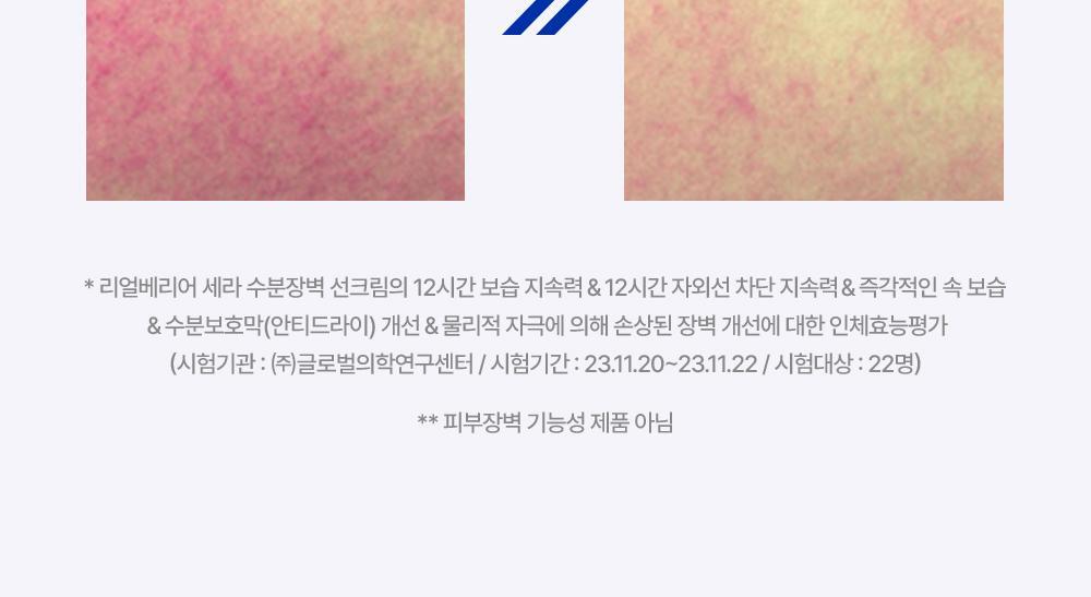 POINT 03. Strengthen the skin barrier damaged by UV rays!