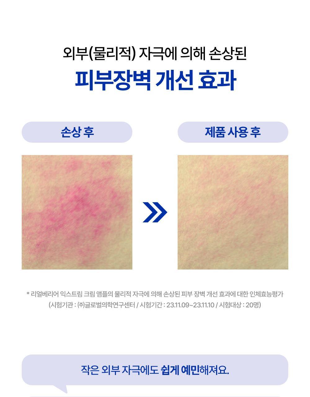 외부 자극에 의해 손상된 피부장벽 개선 효과